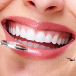 Профессиональная гигиена зубов и полости рта